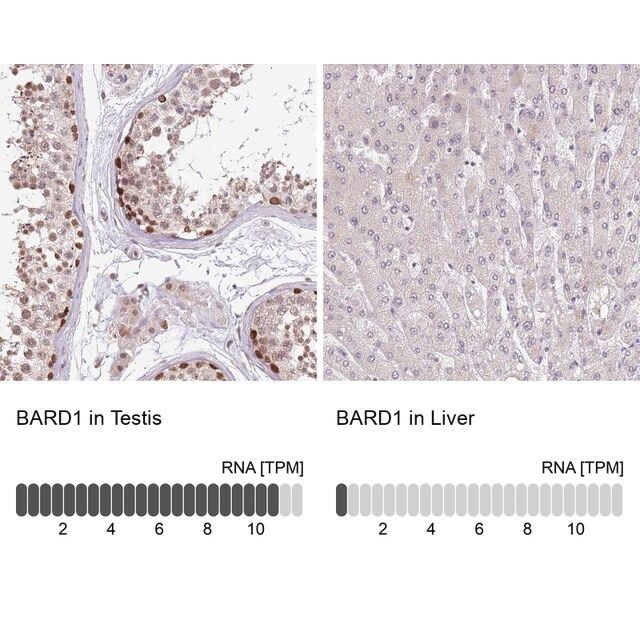 Anti-BARD1 antibody produced in rabbit