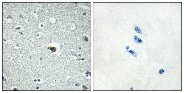 Anti-BAI1 antibody produced in rabbit