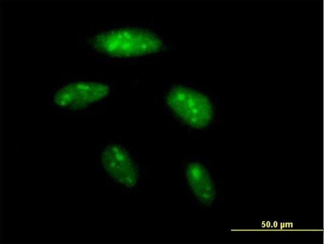 Anti-BAZ2B antibody produced in mouse