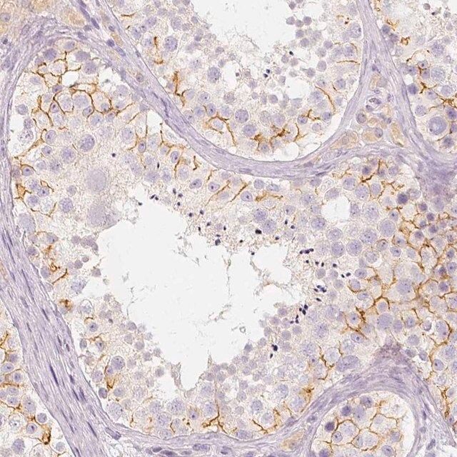 Anti-BATF antibody produced in rabbit