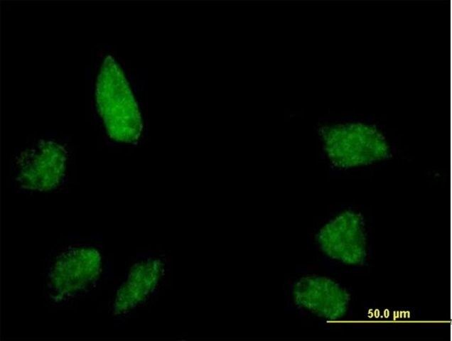 Anti-BANP antibody produced in mouse