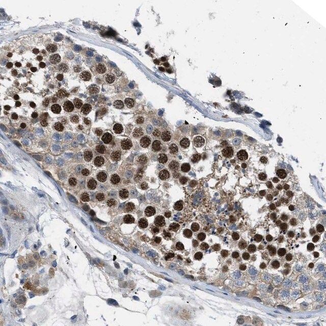 Anti-BAZ2B antibody produced in rabbit