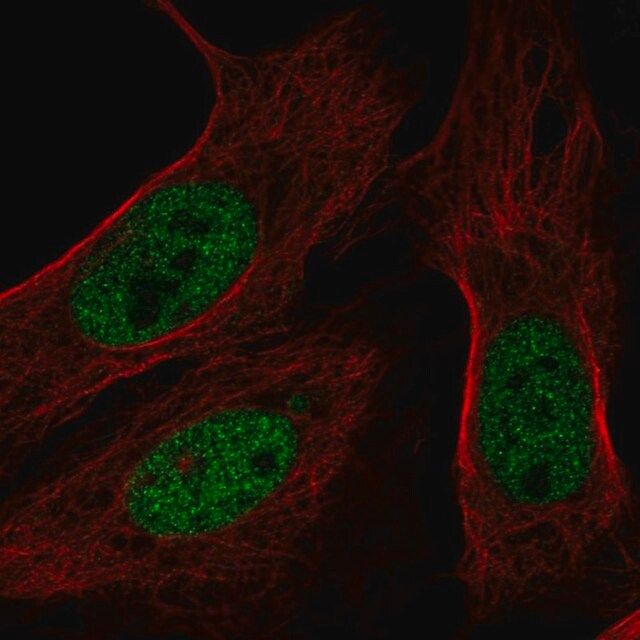 Anti-BAP1 antibody produced in rabbit