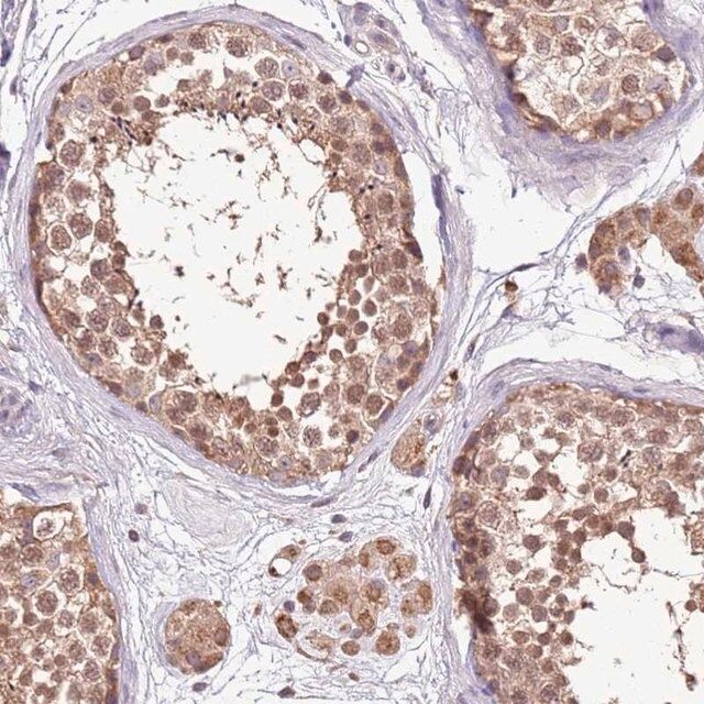 Anti-BBS5 antibody produced in rabbit