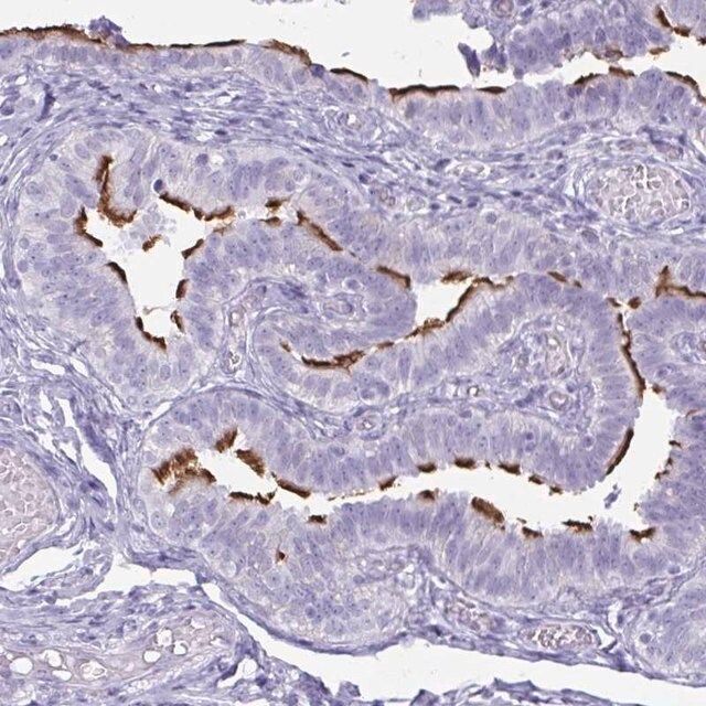 Anti-BBS10 antibody produced in rabbit