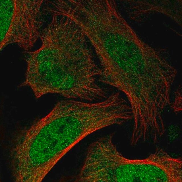 Anti-BAZ2B antibody produced in rabbit