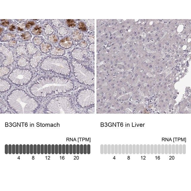 Anti-B3GNT6 antibody produced in rabbit