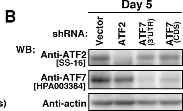 Anti-ATF7 antibody produced in rabbit