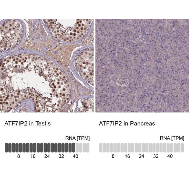 Anti-ATF7IP2 antibody produced in rabbit