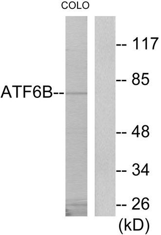 Anti-ATF6B antibody produced in rabbit