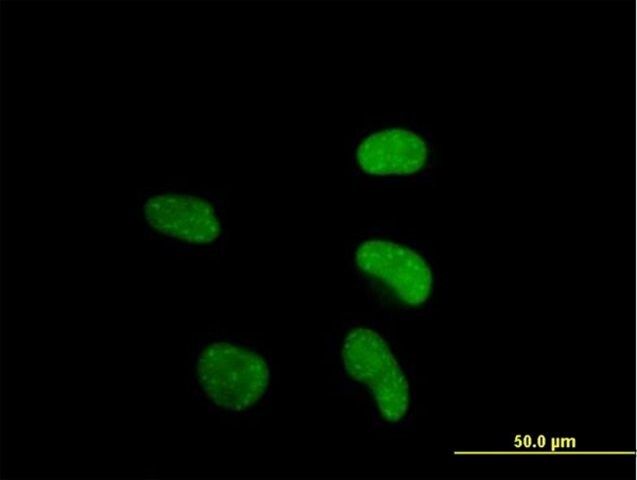 Anti-ATF6 antibody produced in mouse