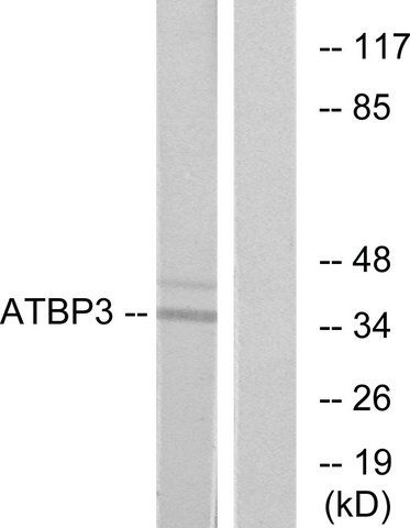 Anti-ATPBD3 antibody produced in rabbit