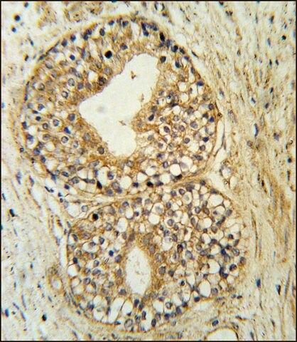 ANTI-ATP11C (CENTER) antibody produced in rabbit