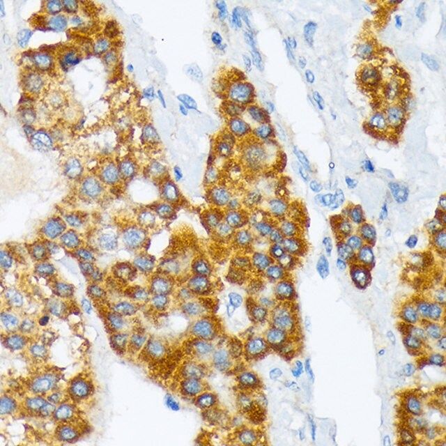 Anti-ATP1B3 antibody produced in rabbit