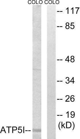 Anti-ATP5I antibody produced in rabbit