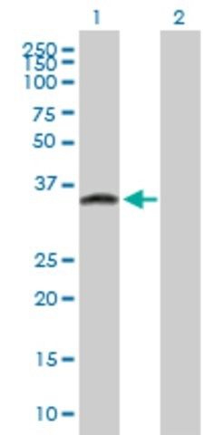 Anti-ATPBD1C antibody produced in mouse