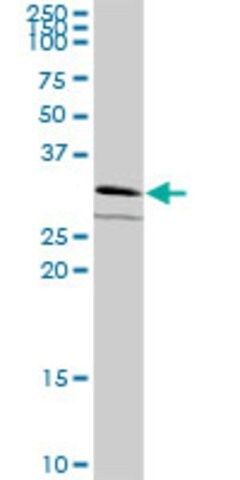 Anti-ATPBD1B antibody produced in mouse