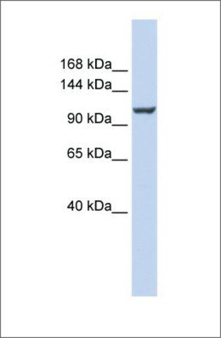 Anti-ATP2B4 antibody produced in rabbit