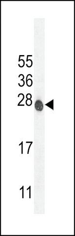 ANTI-ATP6V0C(C-TERMINAL) antibody produced in rabbit