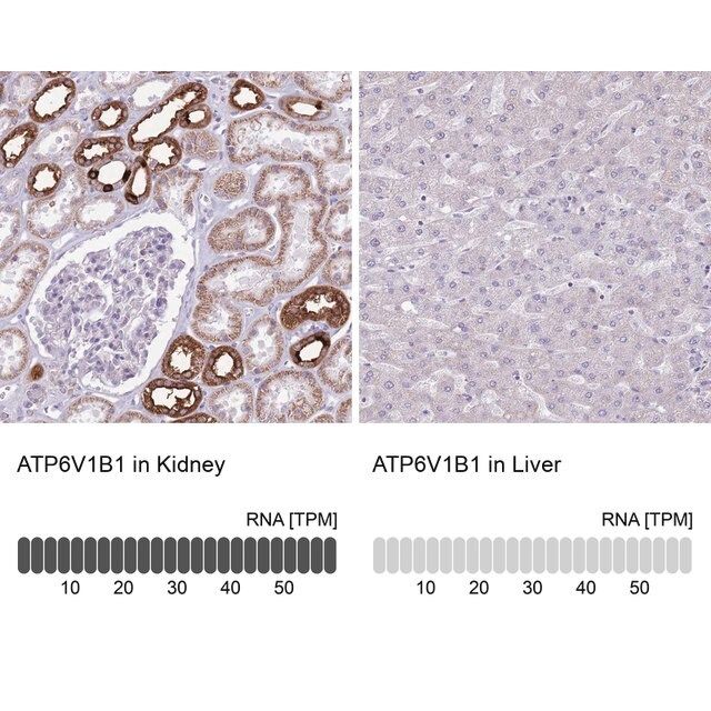 Anti-ATP6V1B1 antibody produced in rabbit