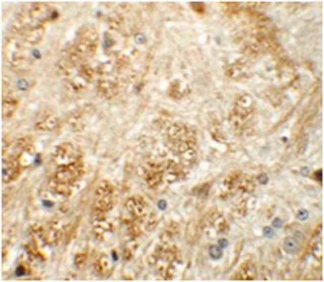 Anti-ATP2C1 Antibody