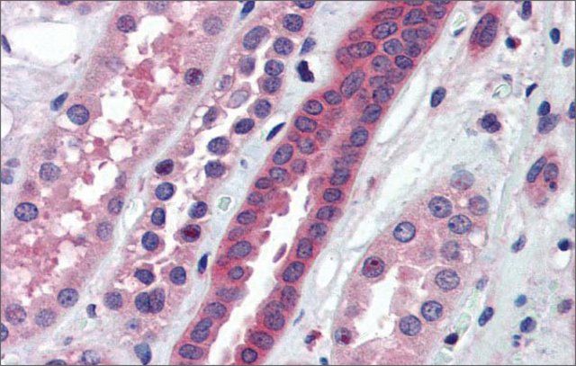 Anti-ATP6V0A2 antibody produced in rabbit