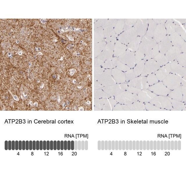 Anti-ATP2B3 antibody produced in rabbit