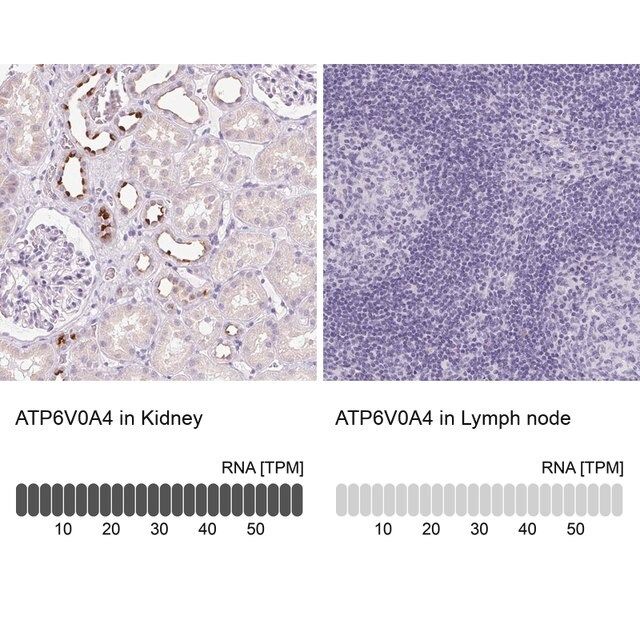 Anti-ATP6V0A4 antibody produced in rabbit