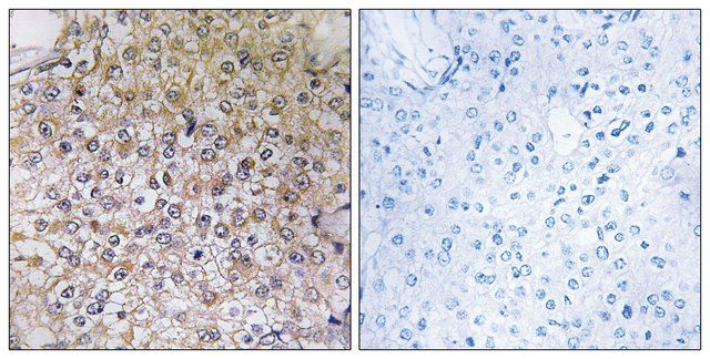 Anti-ATP6V1B1 antibody produced in rabbit