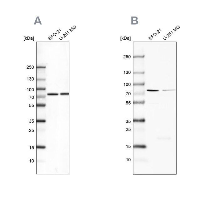 Anti-ATP6V1A antibody produced in rabbit