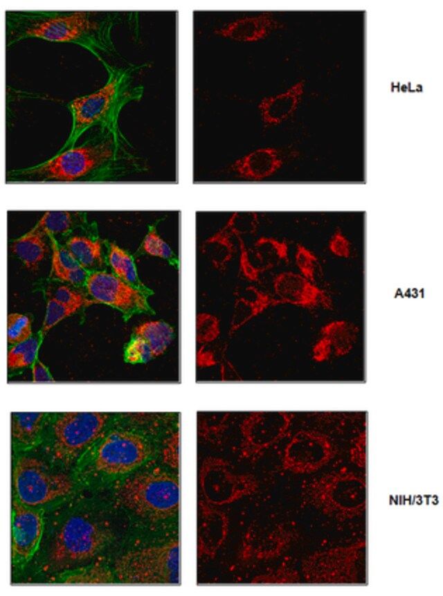 Anti-ATPIF1 Antibody