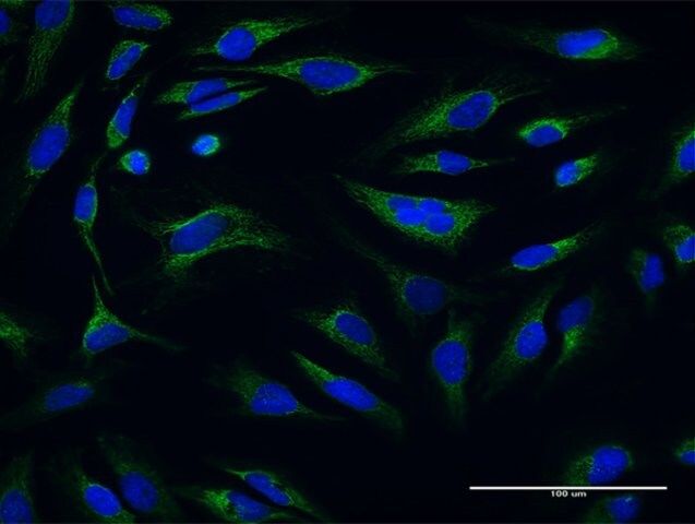 Anti-ATP5O antibody produced in mouse