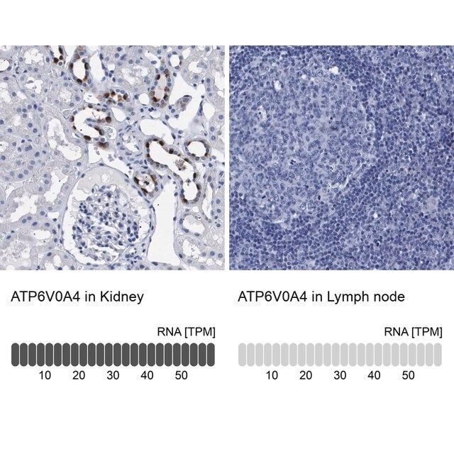 Anti-ATP6V0A4 antibody produced in rabbit