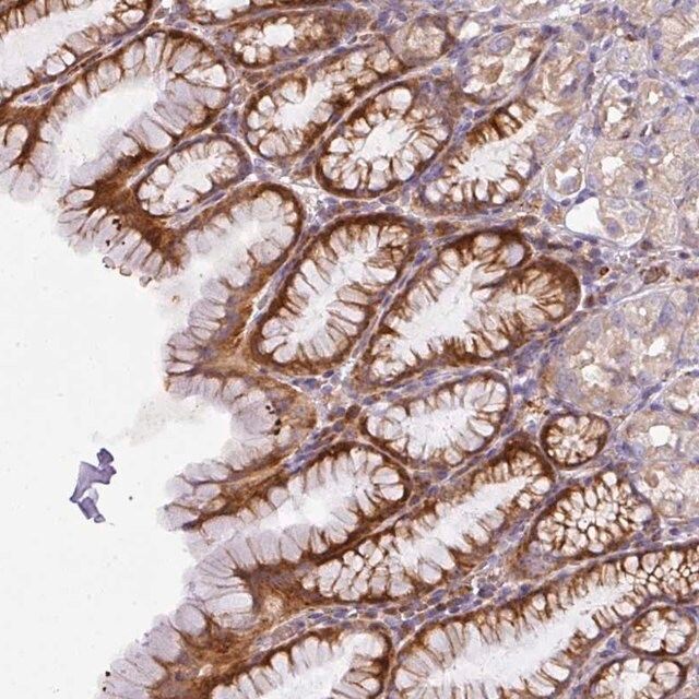 Anti-ATP6V1F antibody produced in rabbit