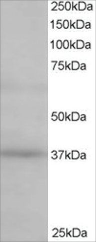 Anti-ATP6IP2/Renin Receptor antibody produced in goat