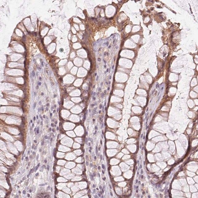 Anti-ATP1B3 antibody produced in rabbit