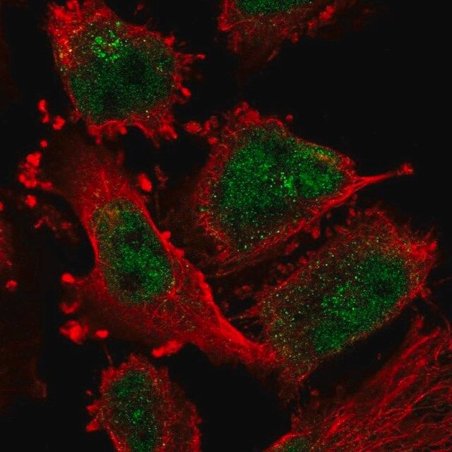 Anti-ATR antibody produced in rabbit