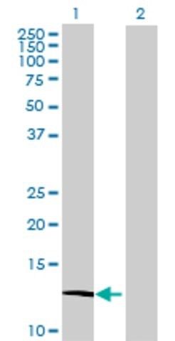 Anti-ATP6V1G3 antibody produced in mouse