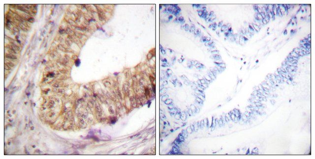 Anti-ATRIP antibody produced in rabbit