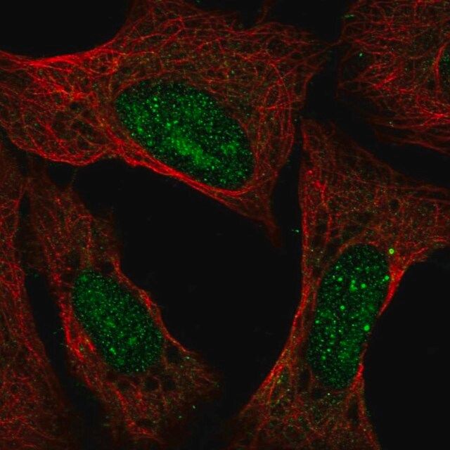 Anti-ATXN3 antibody produced in rabbit