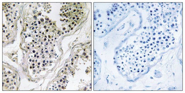 Anti-ATXN7L1 antibody produced in rabbit