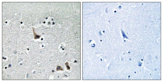 Anti-ATP6V1H antibody produced in rabbit