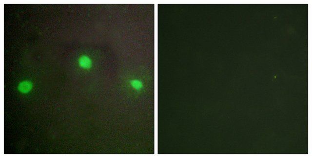 Anti-ATRX antibody produced in rabbit