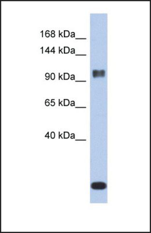 Anti-ATXN7 antibody produced in rabbit