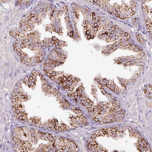 Anti-ATP6V1E2 antibody produced in rabbit