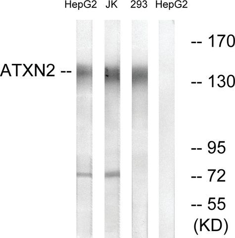 Anti-ATXN2 antibody produced in rabbit