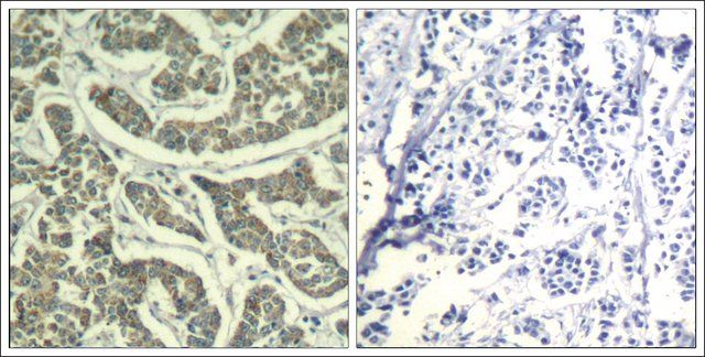 Anti-ATR (Ab-428) antibody produced in rabbit