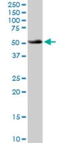 Anti-ATP6V1B1 antibody produced in rabbit