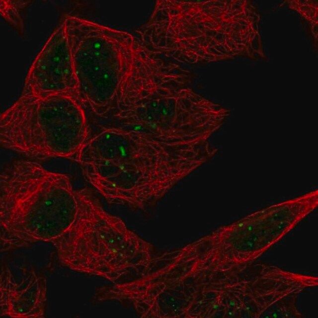 Anti-ATRX antibody produced in rabbit