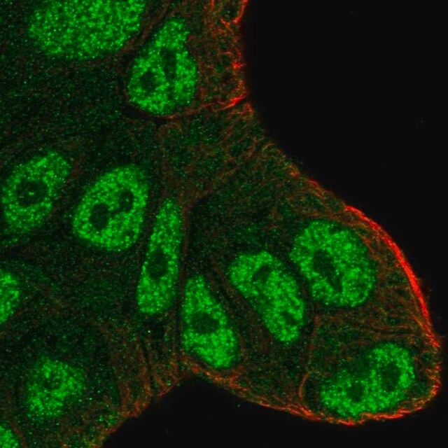 Anti-ATXN1 antibody produced in rabbit